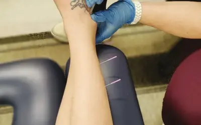 Post-Surgery Recovery: How Physical Therapy Aids in a Faster, Healthier Recovery in Richmond