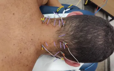 Unlocking Strength and Mobility with Richmond’s Ascend Physical Therapy Programs